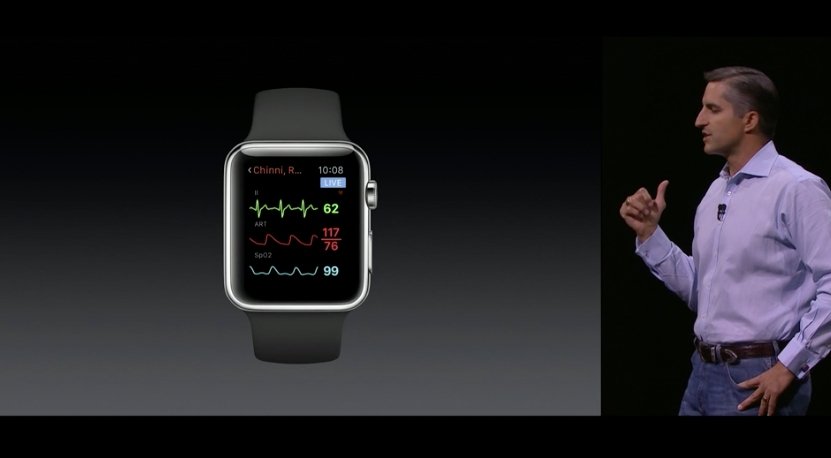 WatchOS 2 tendrá una mayor aplicación en el campo médico