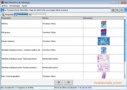 Atlas Interactivo de Histolog�a  0.6 Espa�ol imagen 3