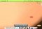 Pimple Popper iPhone image 3 thumbnail