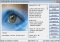 RemoveIT image 1 thumbnail