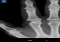 X-Ray Scanner Android image 1 thumbnail