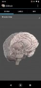 3D Brain imagen 5 Thumbnail