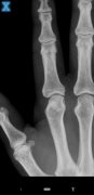 X-Ray Scanner image 1 Thumbnail