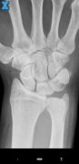 X-Ray Scanner image 5 Thumbnail