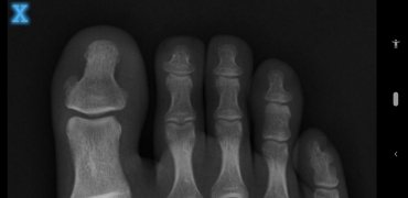 X-Ray Scanner image 6 Thumbnail